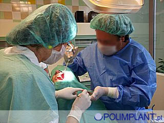 kursy implantologiczne